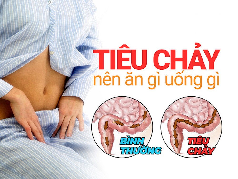 Bị tiêu chảy nên ăn gì? Hướng dẫn chi tiết giúp nhanh hồi phục